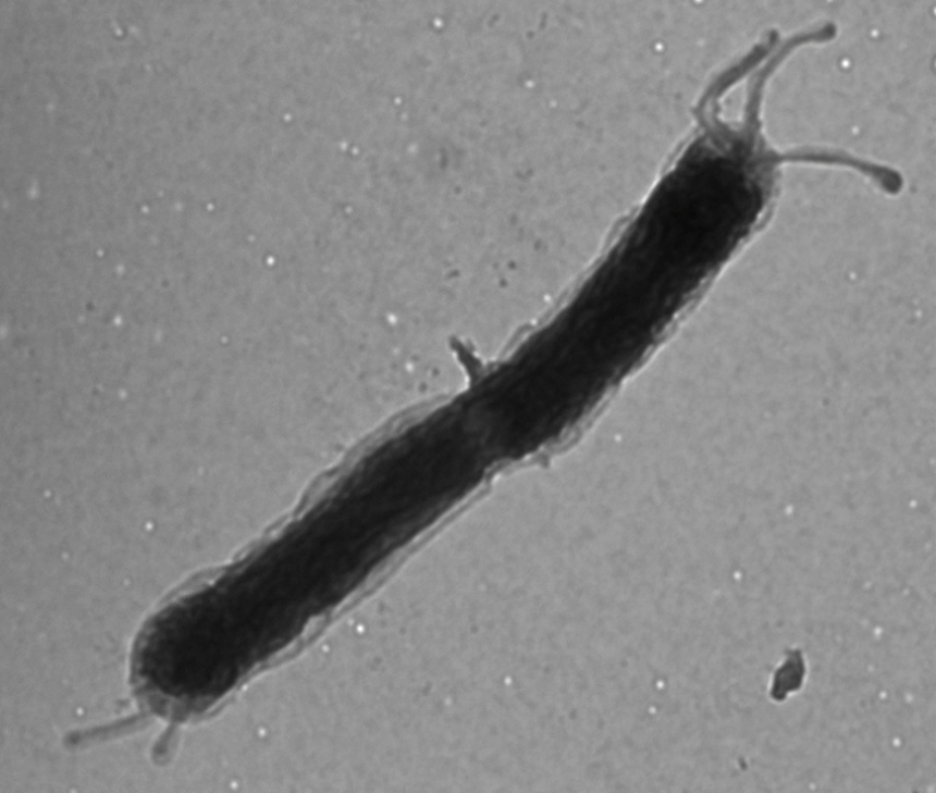 Figure 2. TEM image of a H. pylori fliA mutant.  FliA is an alternative sigma factor required for transcription of genes whose products are required late in flagellar assembly. The bacterium is undergoing cytokinesis and has truncated flagella the cell poles. Image taken by Dr. Jennifer Tsang in the Hoover lab.